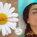 طب سوزنی صورت