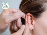 طب سوزنی گوش برای کنترل اشتها