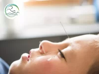 طب سوزنی برای اطفال