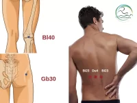 نقاط طب سوزنی درمان کمردرد