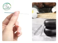 سوزن طب سوزنی